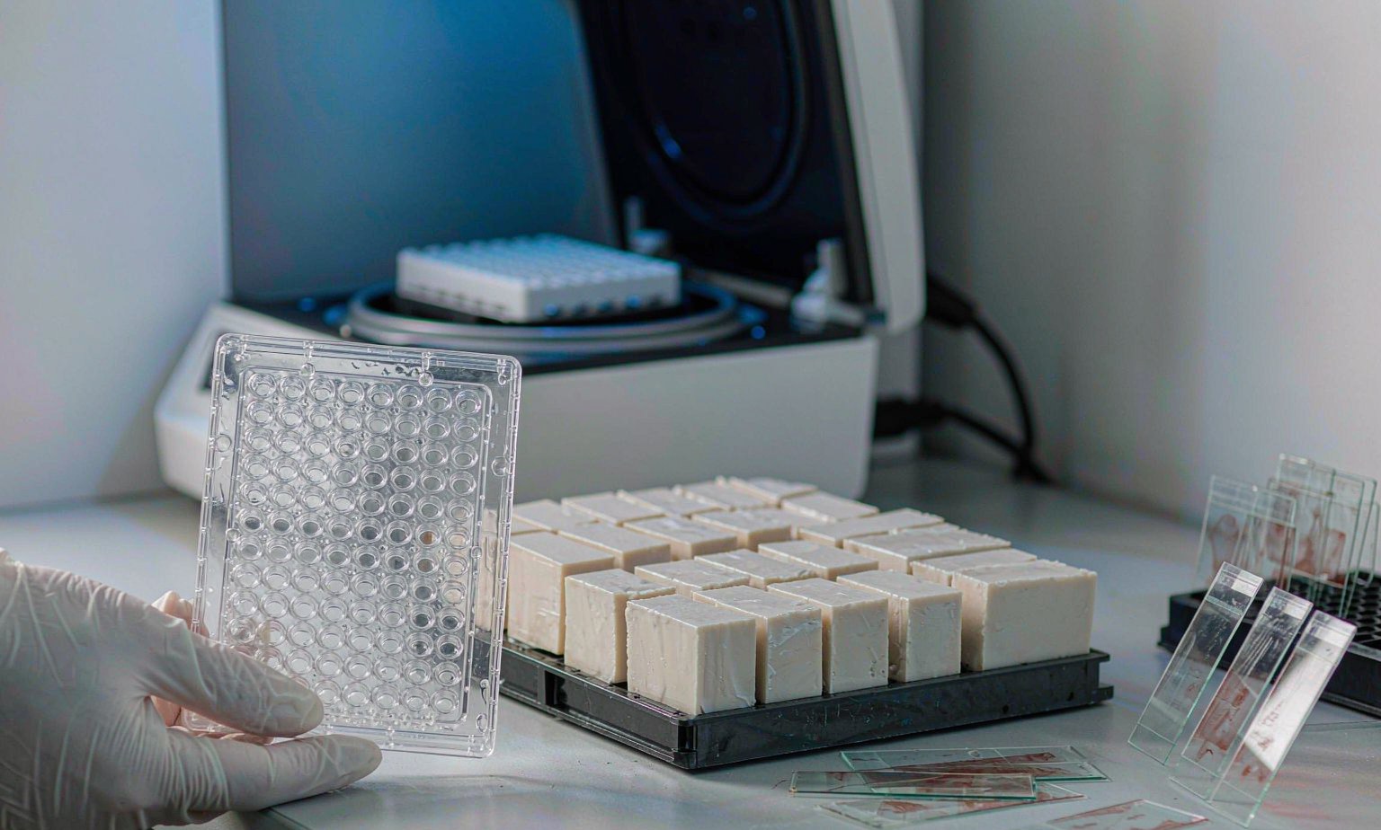 PCR Plate and Colorectal Tumour Tissue Blocks for KRAS Mutation Testing Molecular pathology laboratory bench with a 96-well real-time PCR plate, paraffin-embedded colorectal tumour tissue blocks and stained histology slides used for KRAS codon 12 and 13 mutation testing